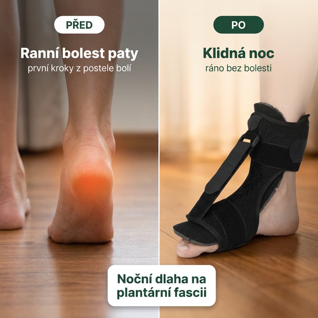 Noční dlaha na plantární fascii před a po – klidná noc a ráno bez bolesti paty